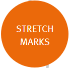 bio oil review stretch marks